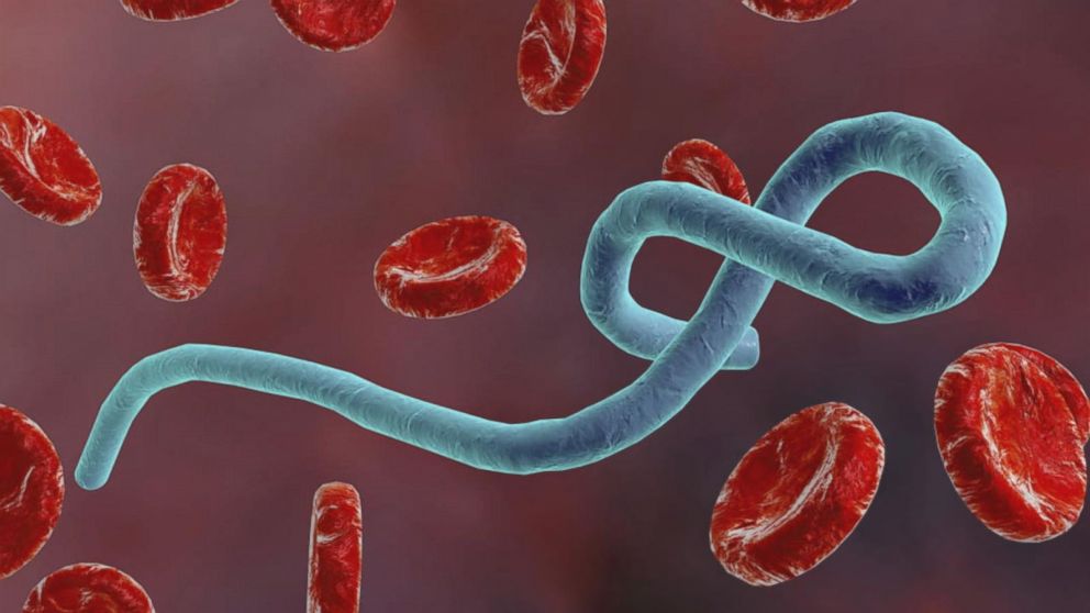Ebola FvzX48